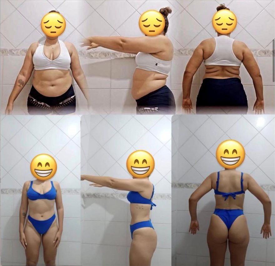 Antes e depois de Joyce M., 12 meses de acompanhamento