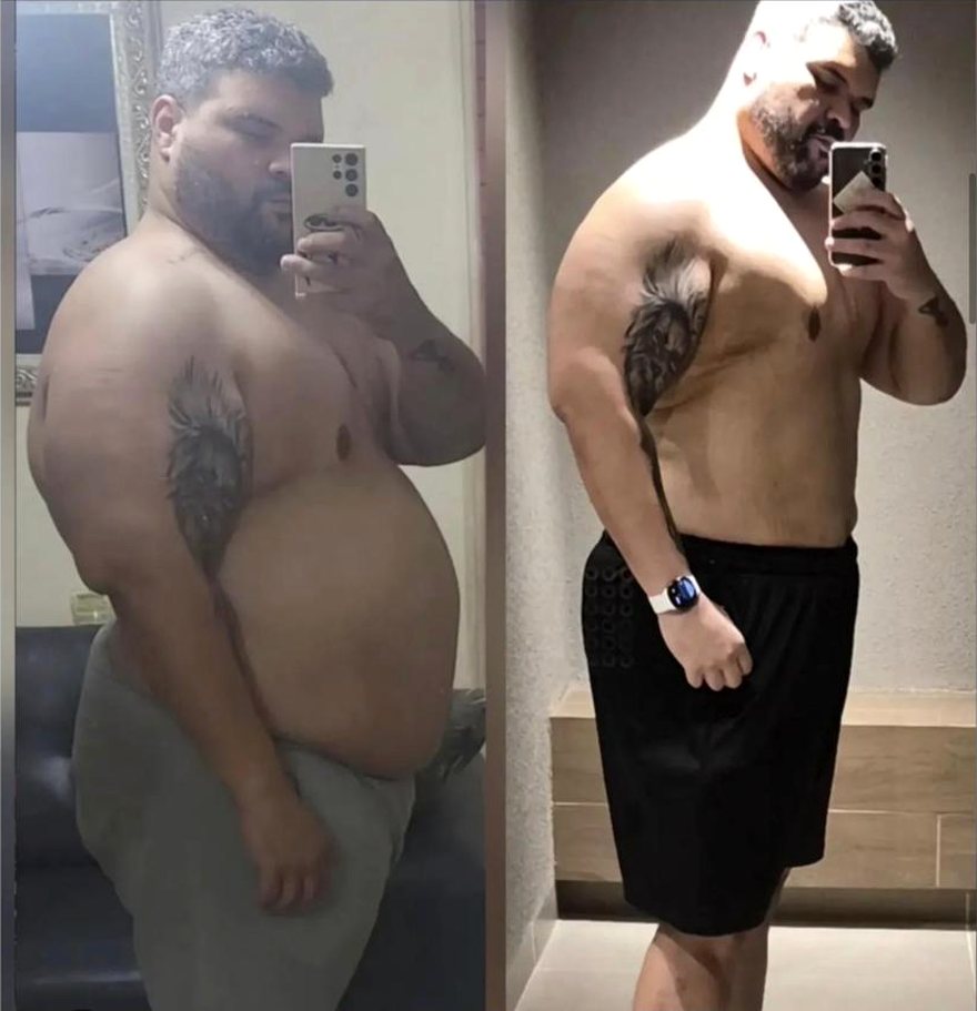 Antes e depois de Edson, 8 meses de acompanhamento